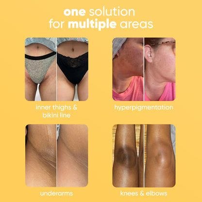 Turmeric Kojic Brightening Scrub